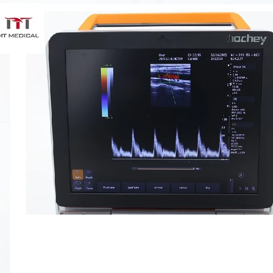 MT Medical Whole Department Portable Heart Tumor Diagnosis Medical Equipment 4D/5D Ultrasound Machine Doppler Color