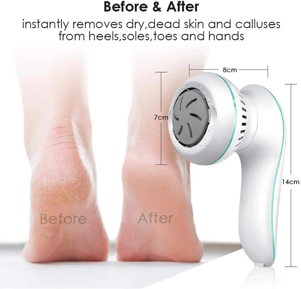 Electric Foot Scrubber Callus Remover Foot File 2 Speed Levels 3 Replacement Pads for Rough Skin Removal