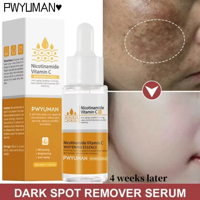 

Freckle Removal Face Serum Whitening Anti-pigmentation Correction Melanin Spot Facial Essence Brighten Skin Care Korean Products