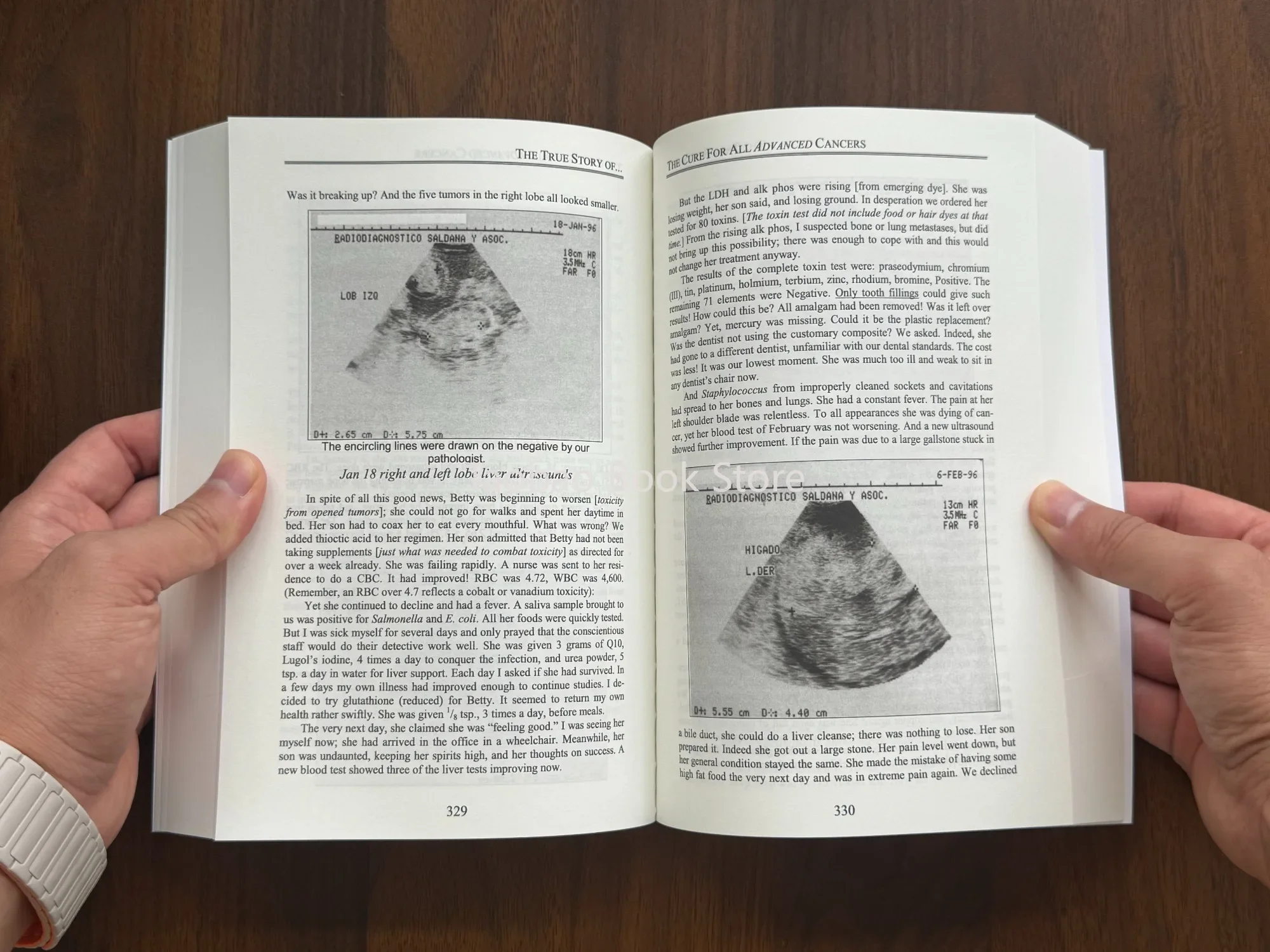 The Cure for All Advanced Cancers Book By Dr. Hulda Clark | Tumor Treatment Natural Therapy Guide  Libros