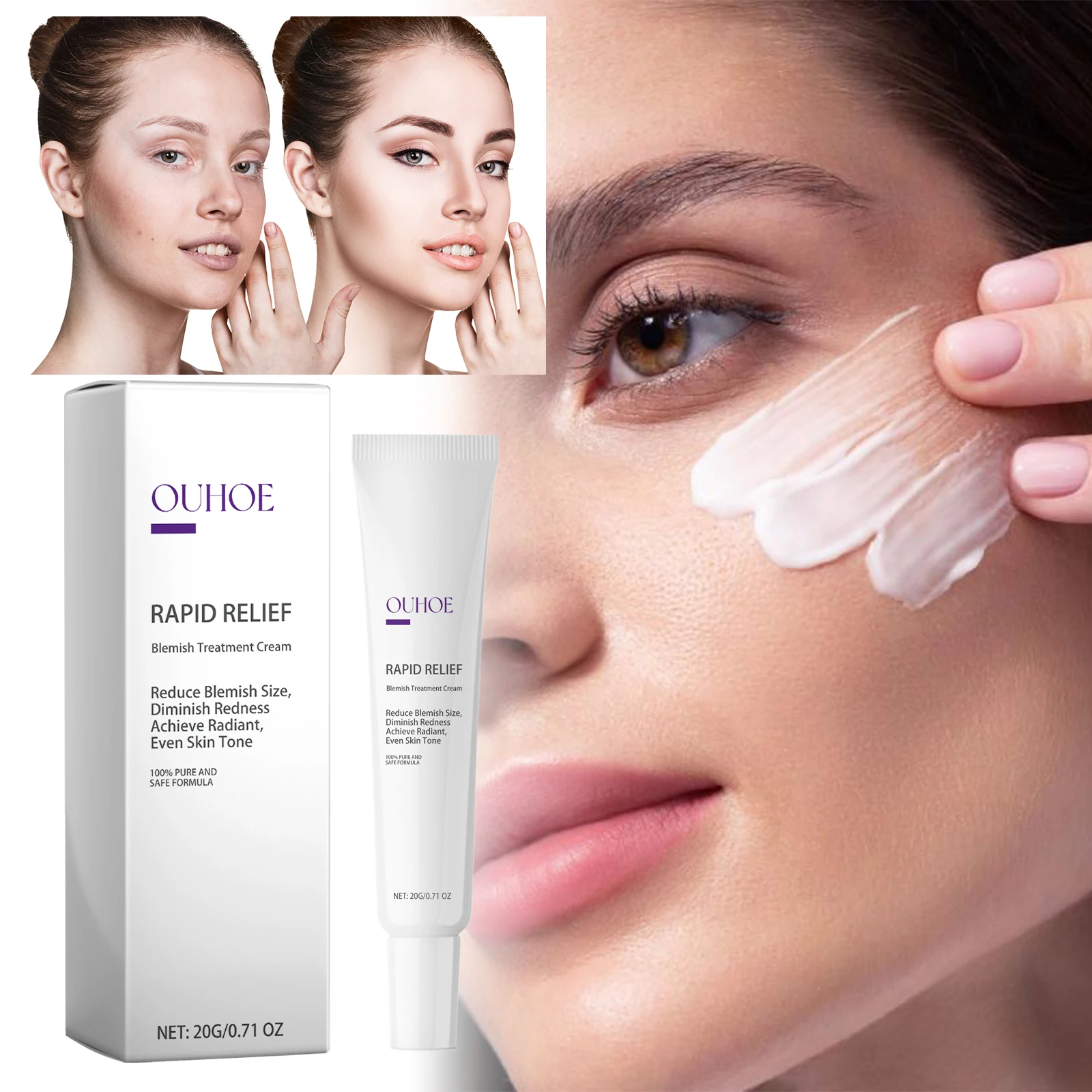 

Brightening Care Cream – Evens Skin Tone, Hydrating, Moisturizing for OUHOE