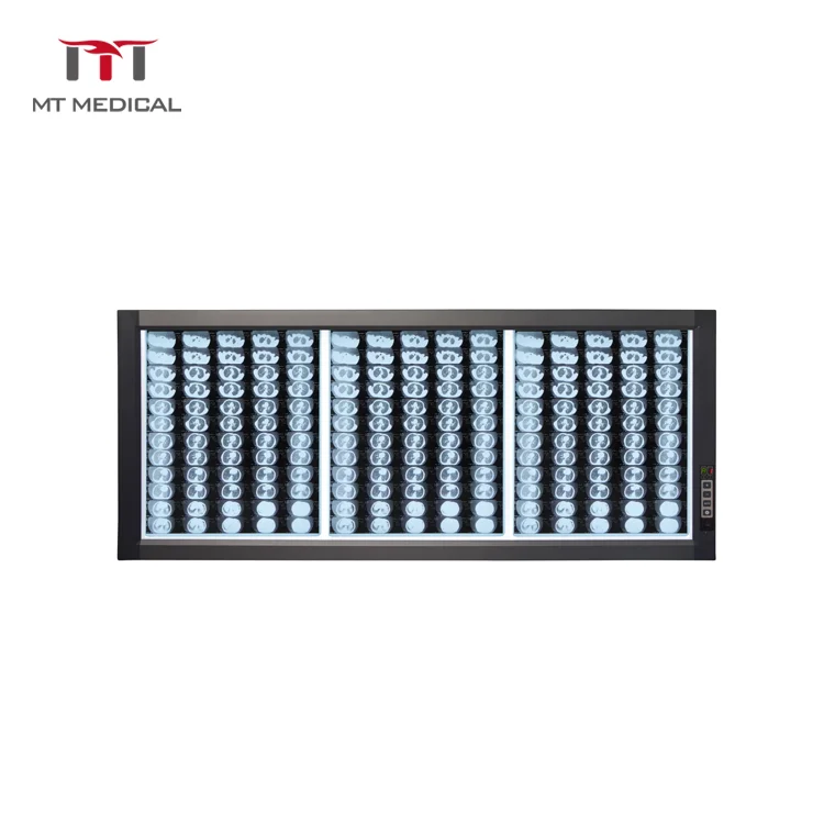

MT MEDICAL LED Medical X-ray Three Panels Side X-ray Film Viewer X Ray Film Viewer Film Viewer