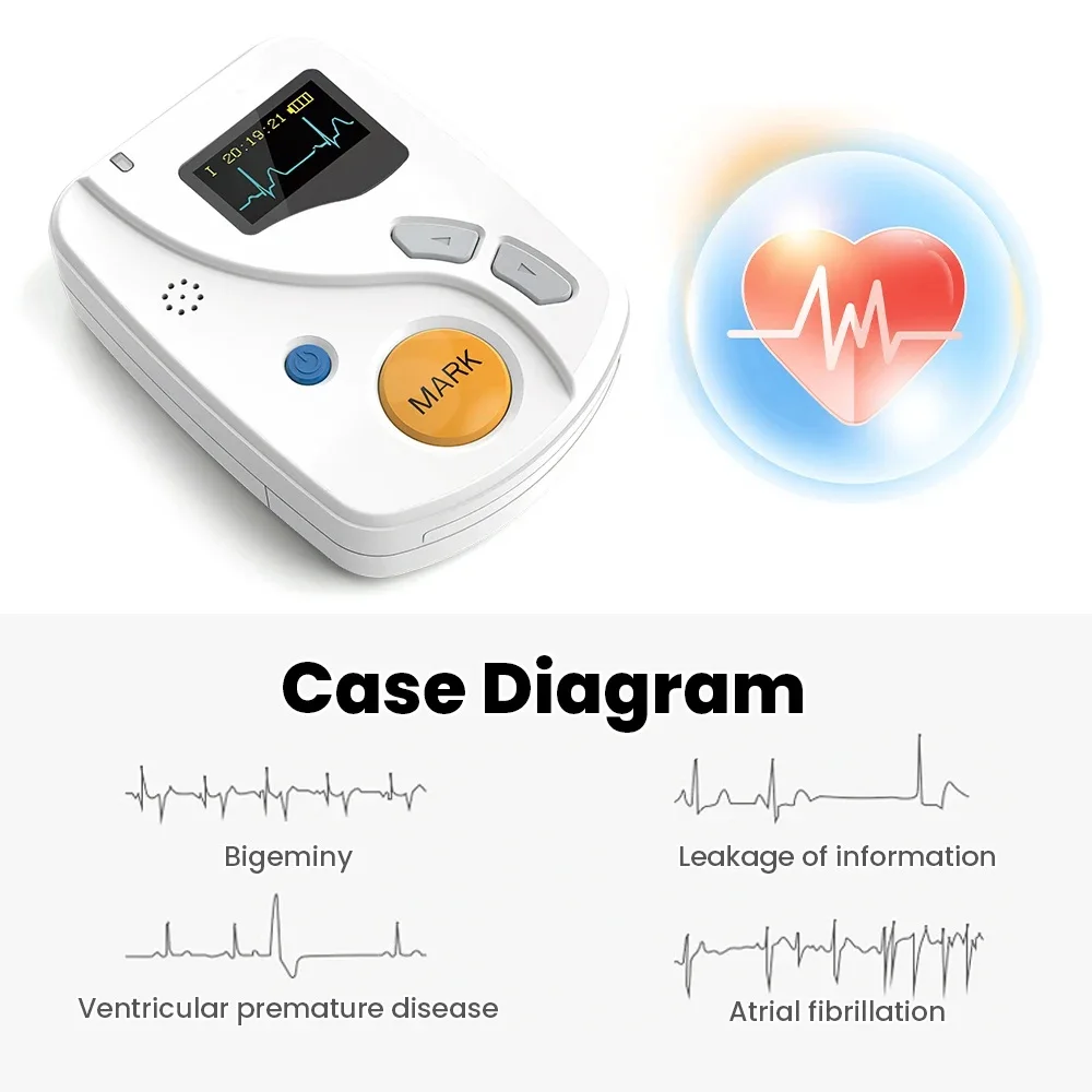 Day & Night Monitoring Holter ECG TLC6000, CONTEC Compact Wearable 12 Lead Ambulatory Heart Wave Tracker