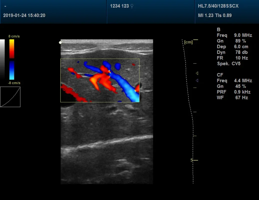 Veterinary Full digital color Doppler Veterinary ultrasound diagnostic instrument