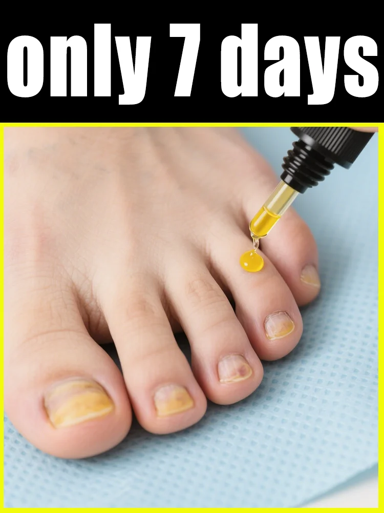 

Quickly eliminate fungus and restore healthy nails