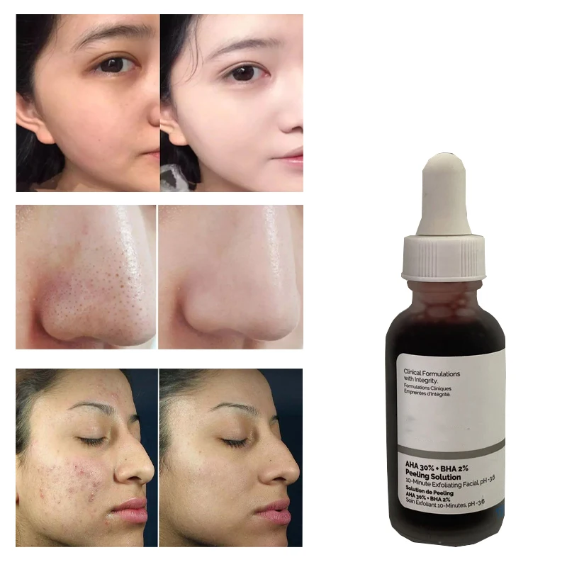 Face Serum 30ML  Ascorbic Acid 8% Alpha Arbutin 2% AHA  30%  BHA 2% Peeling Hydrating Moisturizing Essence Skin Care Product