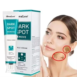Melasma Brightening Face Cream Niacinamide Serum Brighten Cream Fade Fine Lines Lighten Dark Dot Reduce Melanin Face Skincare