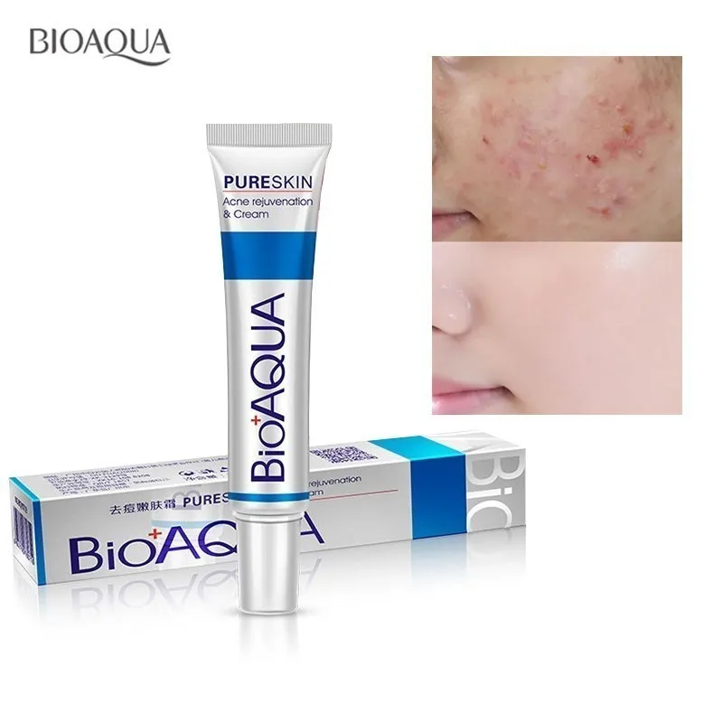 Scopri la Potenza di Bioaqua: Soluzioni Anti-Acne e Cura della Pelle su AliExpress