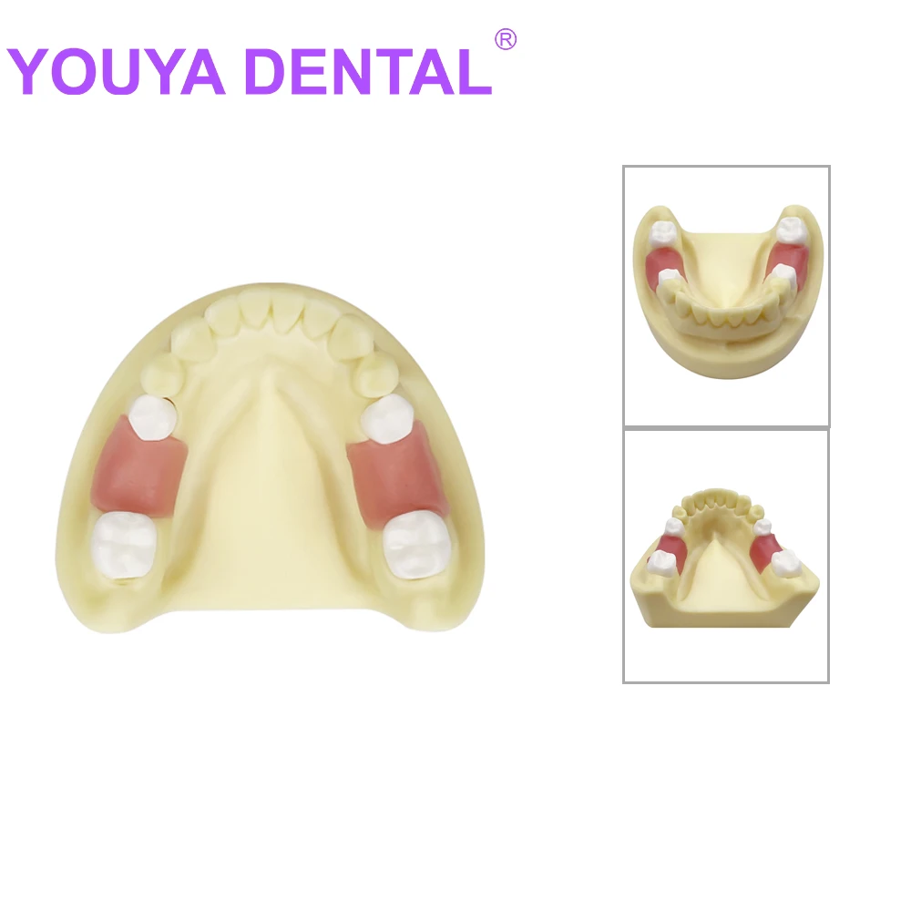 

Teeth Model Dental Teaching Tooth Mandibular Jaw Implant Practice Model Dentistry Typodont Model Training Demonstration Tools