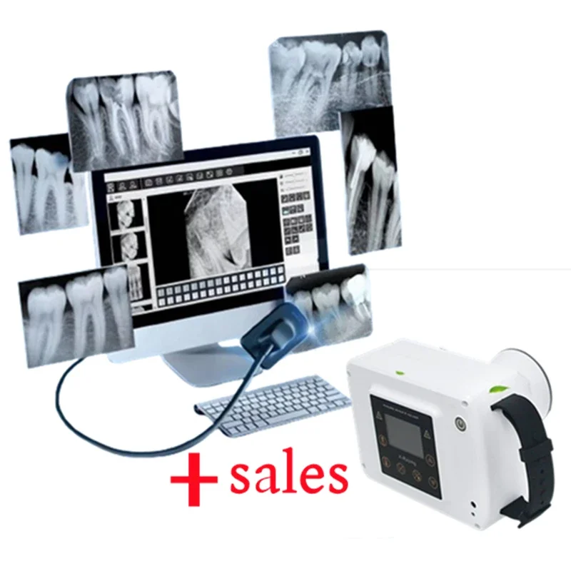 Digital Usb Densor Portable Cheap Price denta X-ray Sensor Intra Oral Rvg denta Sensor