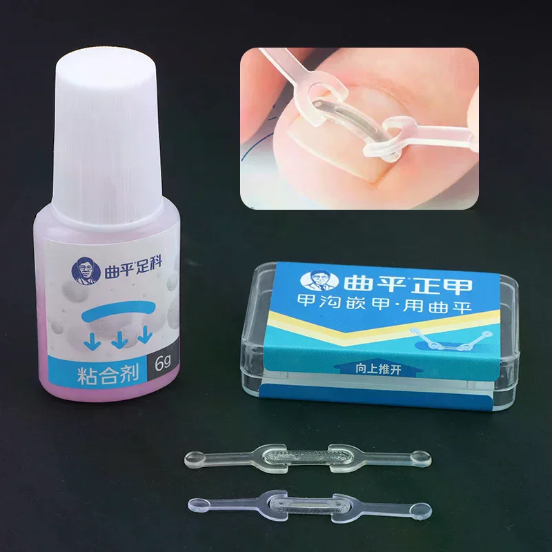 Nagelverzorging Ingegroeide teennagel Correctie Ingegroeide teen Nagelbehandeling Elastische patch Sticker Rechttrekken Clip Brace Pedicure Tool