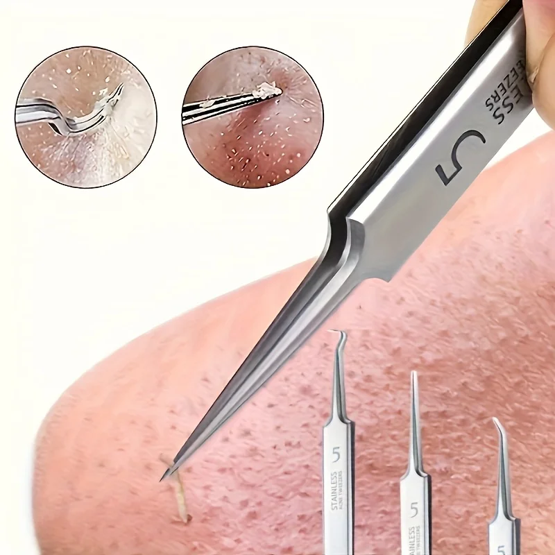1/3/8 szt. Stalowe pęsety do usuwania zaskórników, ultra-dokładne do czyszczenia głębokiego, hipoalergiczne narzędzia