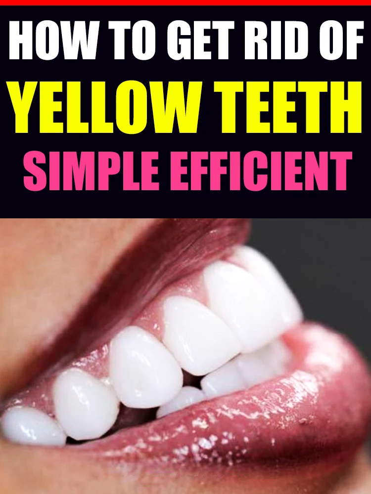 

Perfecting teeth, eliminating cavities, and effectively achieving oral balance