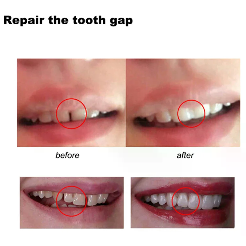 Temporary Tooth Repair Teeth and Gap Falseteeth Solid Glue Denture Adhesive Tool For Daily Use