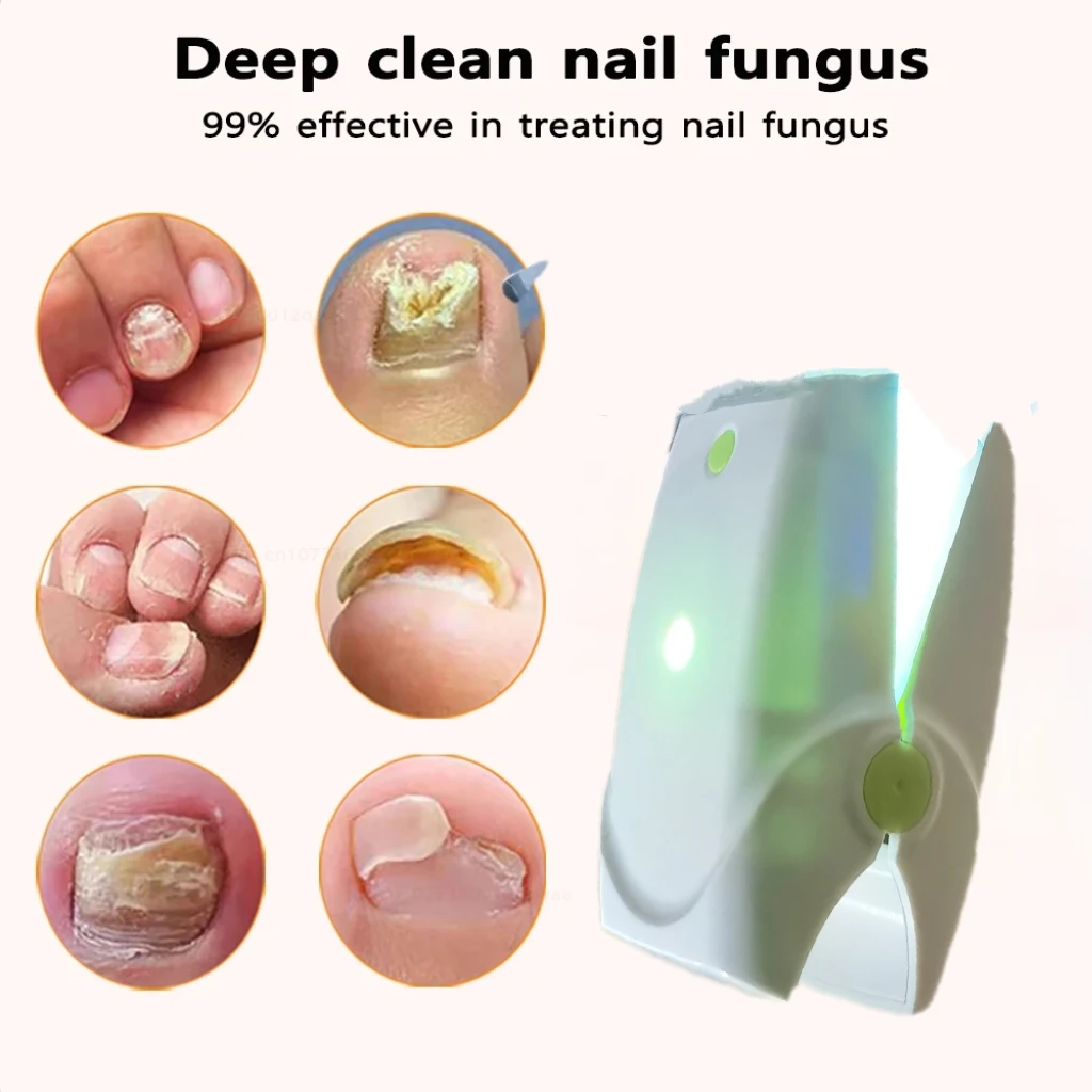 

Portable Nail Laser Instrument For Daily Toenail Maintenance & Fungal Situation Care