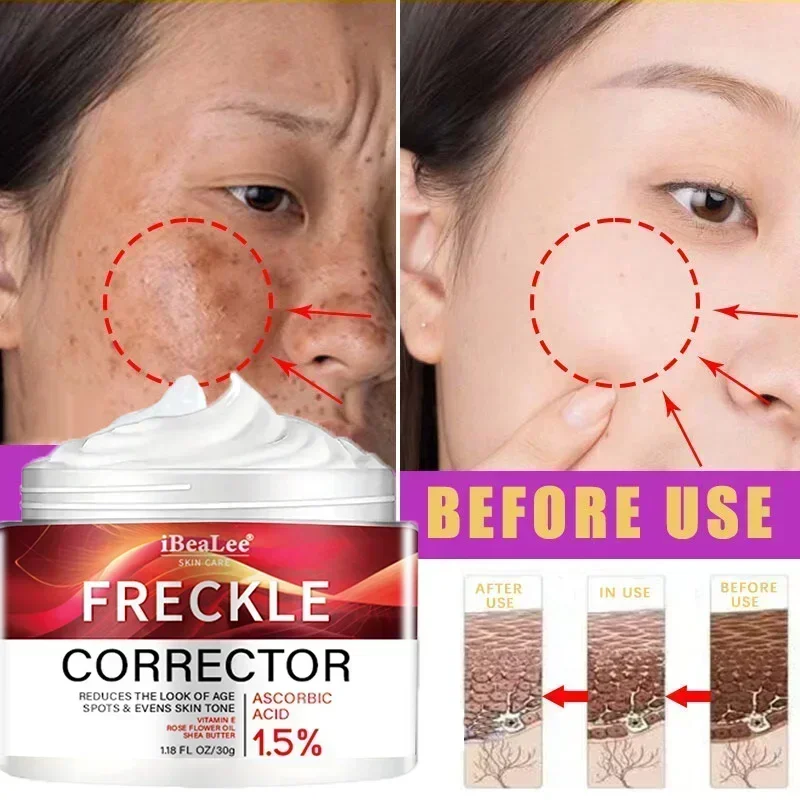 Hot Powerful Whitening Cream Skin Care Remove Freckle Melasma Dark Spots Corrector Lighten Melanin Pigmentation Brighten Product