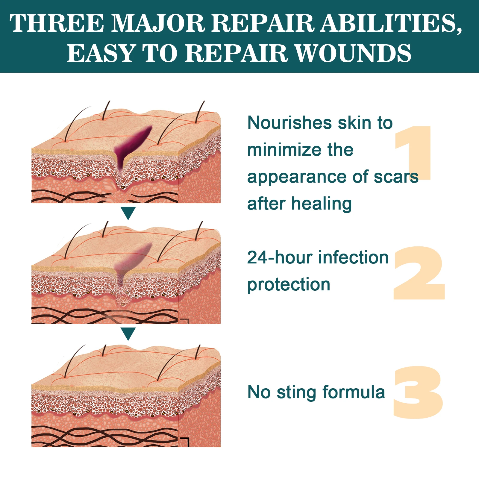 28.3g Antibiotic Ointment Wound Infection Protection Scar Fade Ointment Scratches Recovery Wound Repair Care Cream Relief Skin
