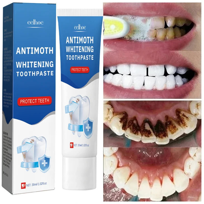 Fast Remove Smoke Stains Toothpaste Remove Plaque Stains Oral Hygiene Cleaning Fresh Breath Teeth Whiten Tools Oral Health Care