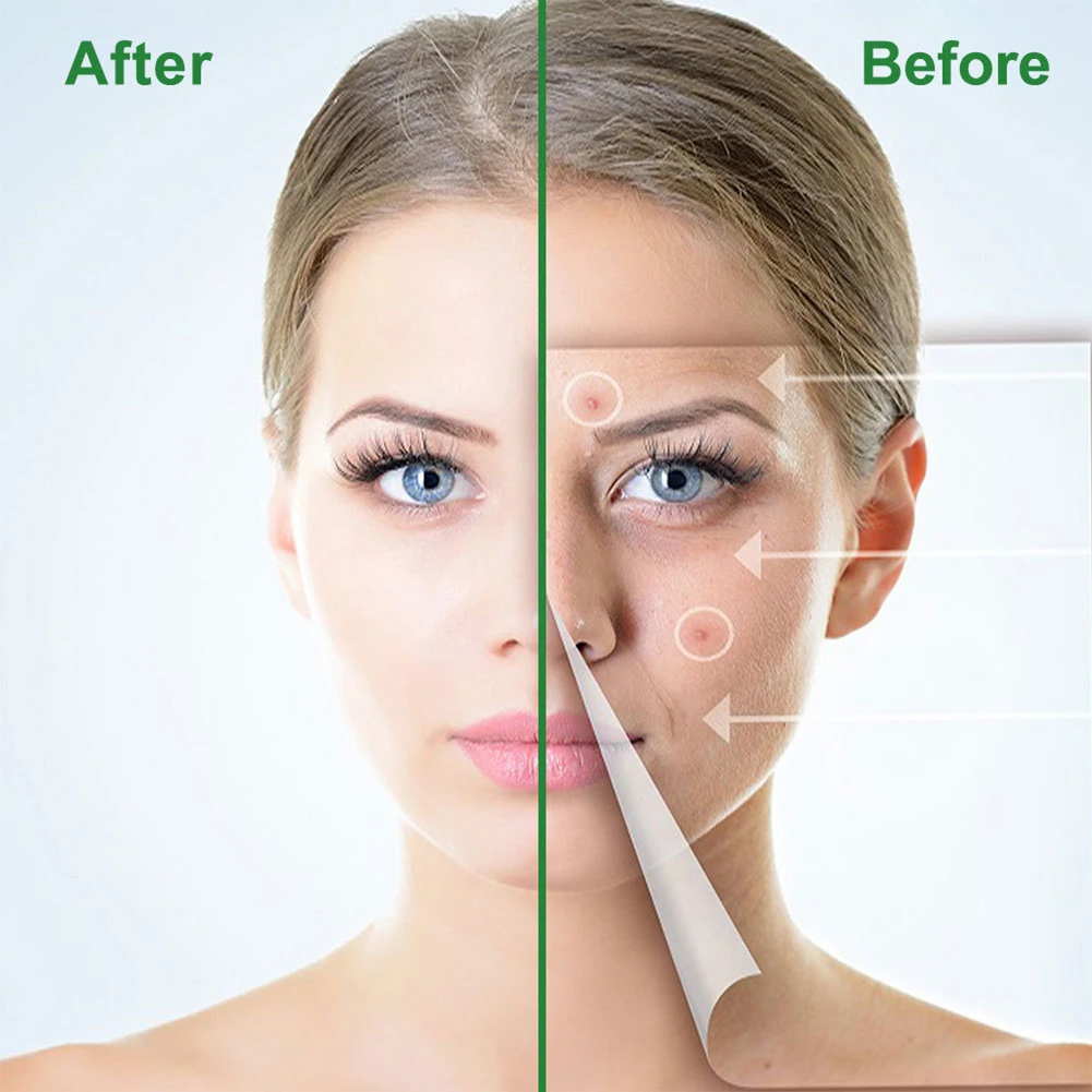 رقعة بثور حب الشباب غير المرئية ، ملصقات تغطية حب الشباب ، شفافة ، غروانية مائية ، بقع حب الشباب ، علاج للوجه والجسم ، عدد 24 ، 36
