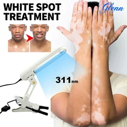 Eficaz Vitiligo Psoríase Tratamento Lâmpada, Medical LED Luz UVB, 311nm