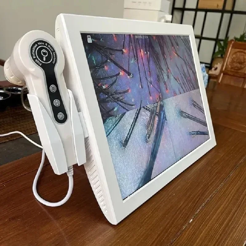 

Professional Hd Hair Follicles Scalp Scanner Detector Hair Analyzer / Skin And Scalp Hair Analysis Machine