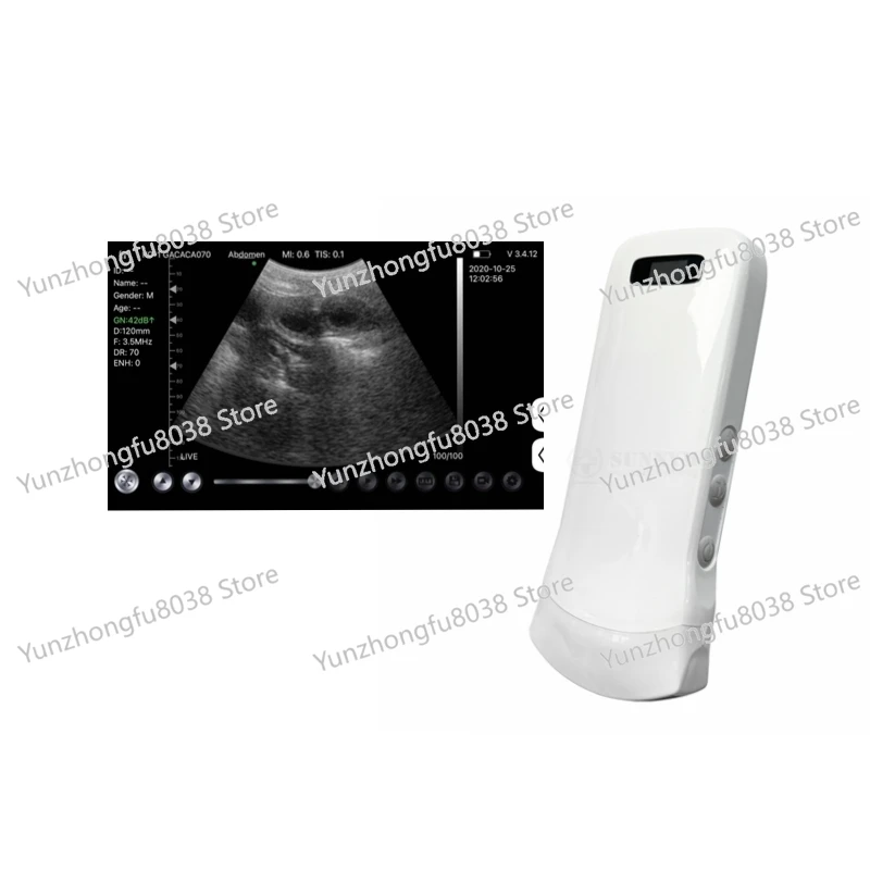 SY-A0C1 Cheap Wireless black and white ultrasound probe for medical students training convex scanner probe