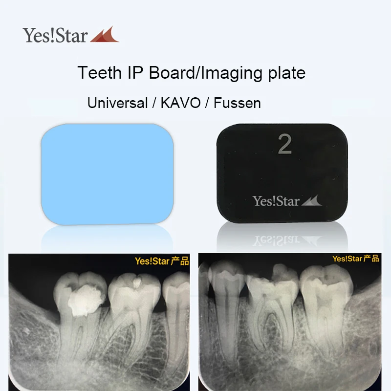 Yes Star Dental Digital Imaging Phosphor IP Plates Phosphor Plate Board CR Phosphor X-ray ImagingScanner Accessory