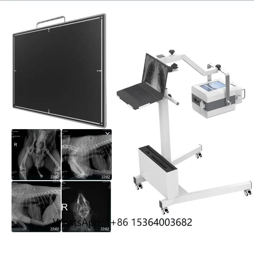 

DR System Flat Panel Detector X-Ray/Medical Xray Machine Digit for Radiography Diagnosis