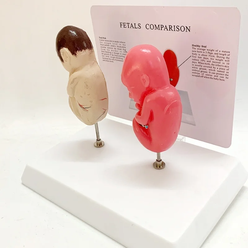 Comparative model of human fetus, demonstration of visceral organ anatomy and pathology, simulation of fetal teaching model