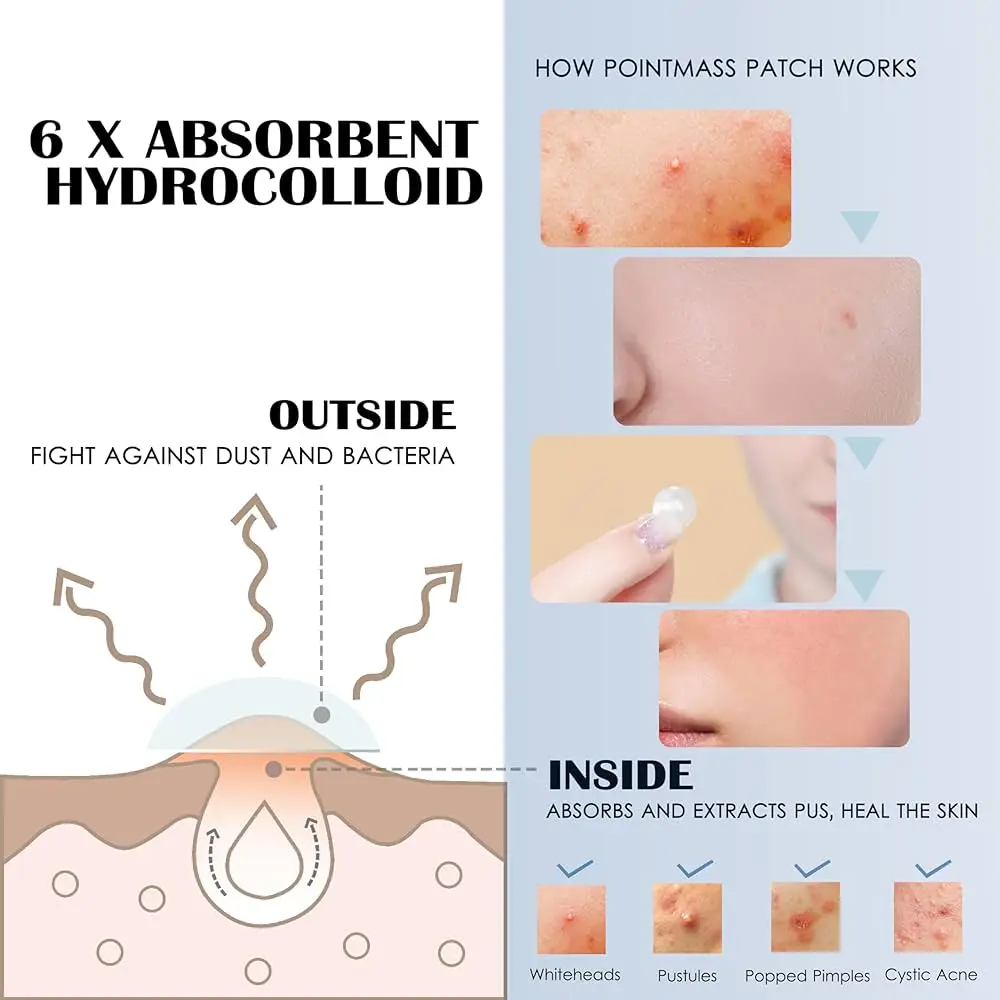 ニキビパッチ 目立たないニキビカバー 顔の油分コントロール 治療 ニキビ吸収液 透明ニキビ洗浄パッチ