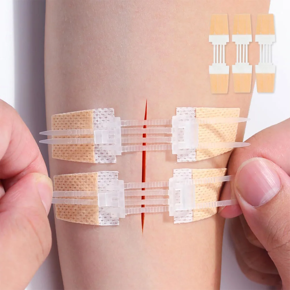 3Pcs/set Zipper Wound Closure Patches Portable Band-Aid Tie Hemostatic Patch Wound Fast Suture Sticking Plaster