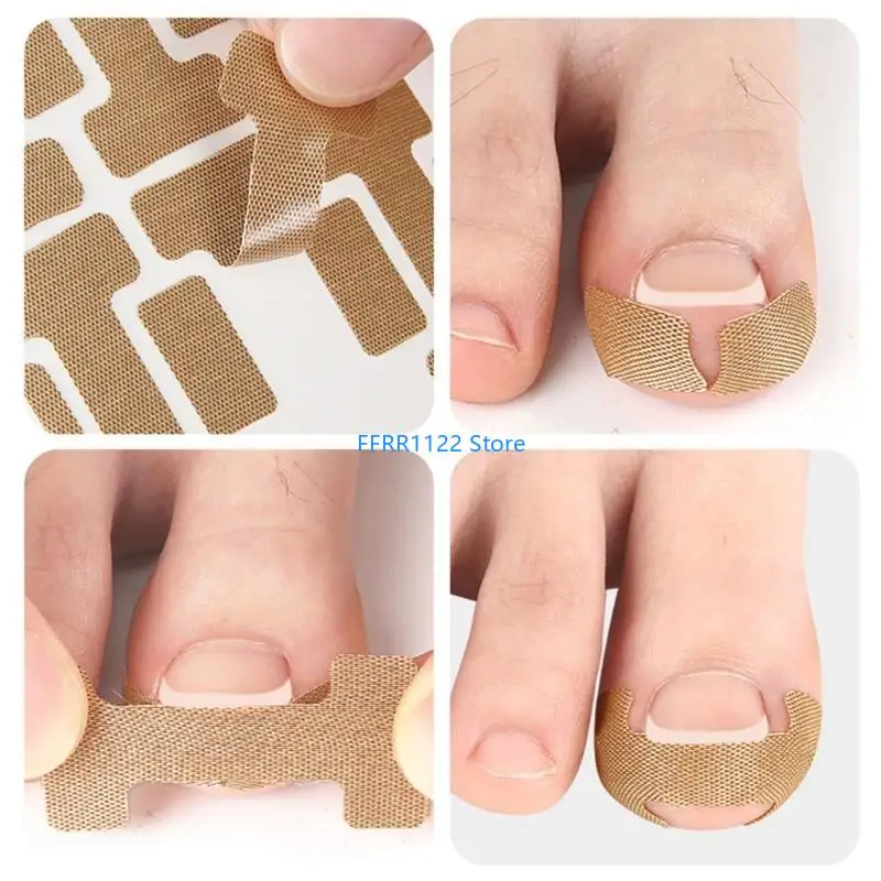 y1uf 10 pcs أظافر تصحيح بقع تصحيح أظافر الصعود التنفس