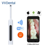 Camara Intraoral Dental Wireless HD 3MP Wifi Intra Oral Scanner Endoscope Teeth Monitor for IOS Android Phone PC