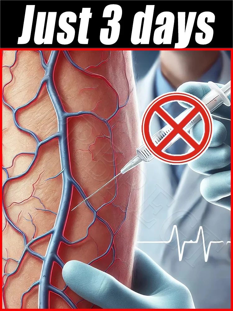 

Этот метод улучшения варикозного расширения вен, помощь вы говорят на «паутевая перемычка» .