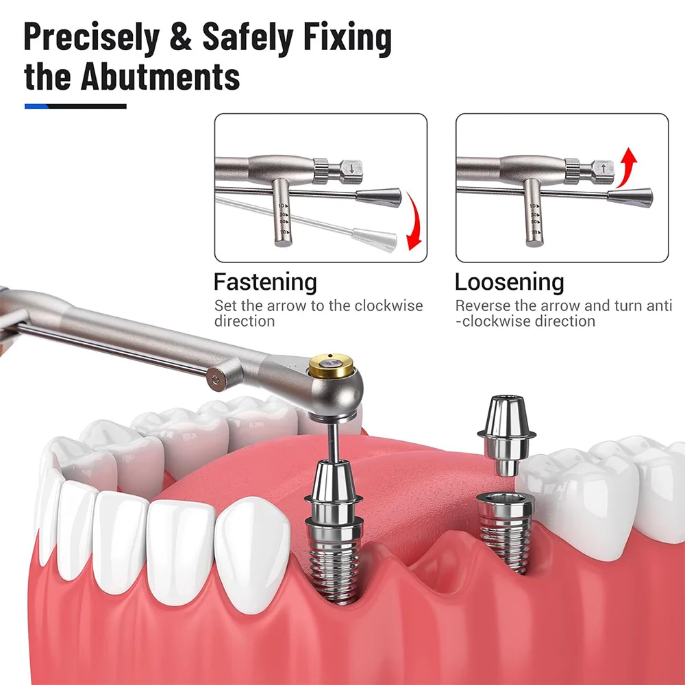 Dental Implant Kit with Universal Prosthetic Torque Wrench Screwdriver Tool Secure/Disassemble Implant Restorations