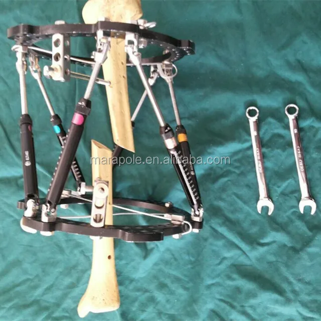 The Taylor SPATIAL FRAME for External fixation