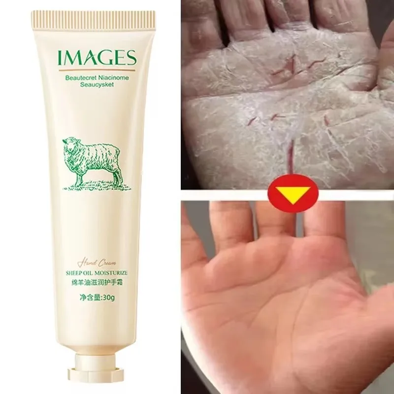 Crema de manos antiarrugas de colágeno, suaviza la piel, nutre, antisecado, blanqueamiento, hidratante, producto de reparación agrietado, cuidado coreano de la piel