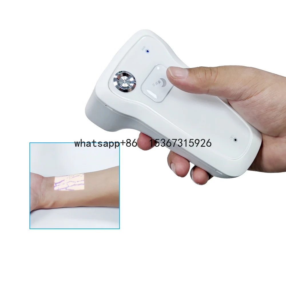 Quick vein finding device, clear vein development, portable vein detector, identification vein device, vein device