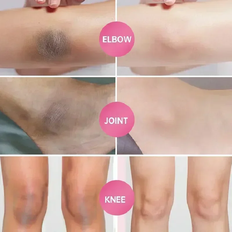 

Brighten Underarm beauty cream Armpit Legs Knee Elbow Bleaching Cream Dull Remove Dark Spots Melanin Skin Care Body Whitening