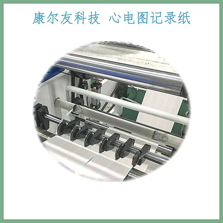 ECG Thermal Paper Roll 210x140mm, 20m Length, High-Quality Compatible Recording Paper