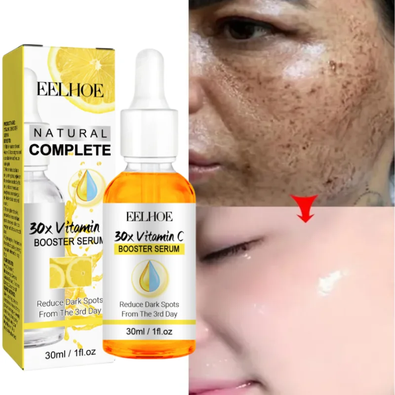 

VC Whitening Freckles Face Serum Effective Remove Dark Spots Fade Melanin Improve Dullness Essence Brighten Repair Skin Care
