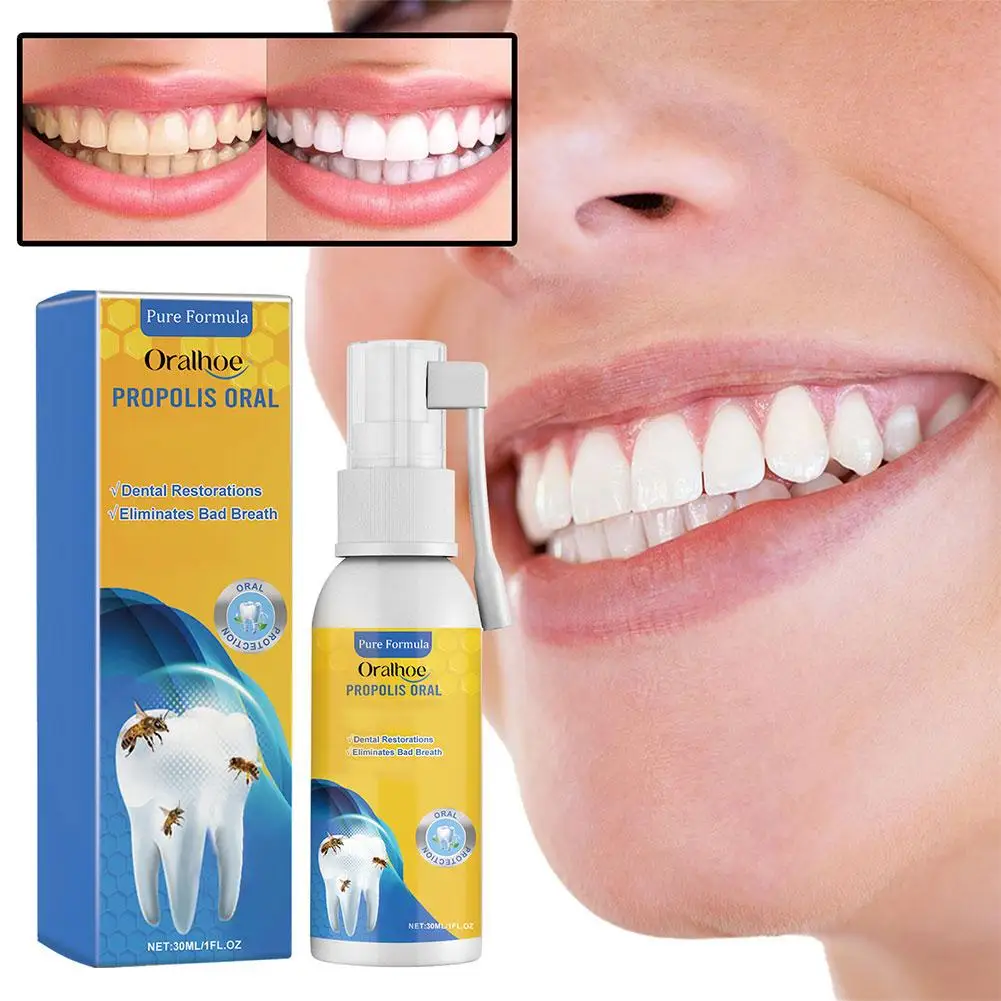 30ml Propolis Oral Instant Treatment Spray Oral Treatment Effectively Bad Health Clean Care Breath Mouth Keeps Oral Refresh C6R4