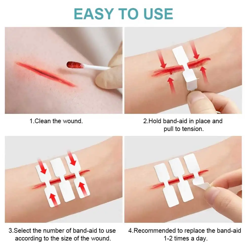 10 pces-100 pces ao ar livre ferida fita adesiva descartável primeiros socorros ferida sutura remendo ferida de emergência rápida sutura remendo