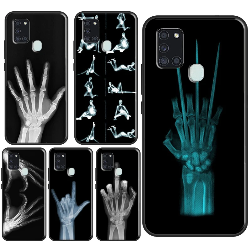 X-ray Hand Bones Case For Samsung Galaxy A52 A32 A22 A12 A13 A23 A33 A53 A73 A14 A24 A34 A54 A71 A51 Cover