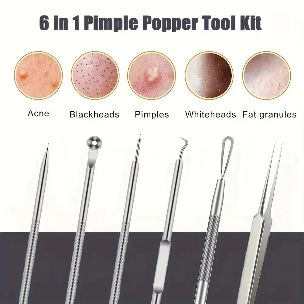 Comédon de points noirs d'acné, dissolvant de boutons et de imperfections, soins de la peau pour femmes, beauté, traitement de l'acné, nettoyeur de pores, crochet à aiguille, 4 pièces