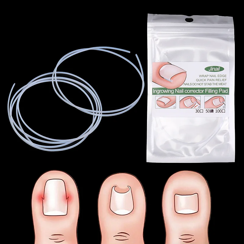 

Ingrown Toenail Correction Tool Ingrown Toe Nail Treatment Elastic Patch Sticker Straightening Clip Brace Pedicure Tool