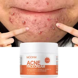 Acne Treatment Cream Anti Acne Face Cream Pimple Removal Spots Oil Control Shrink Pores Moisturizing Skin Care Cream