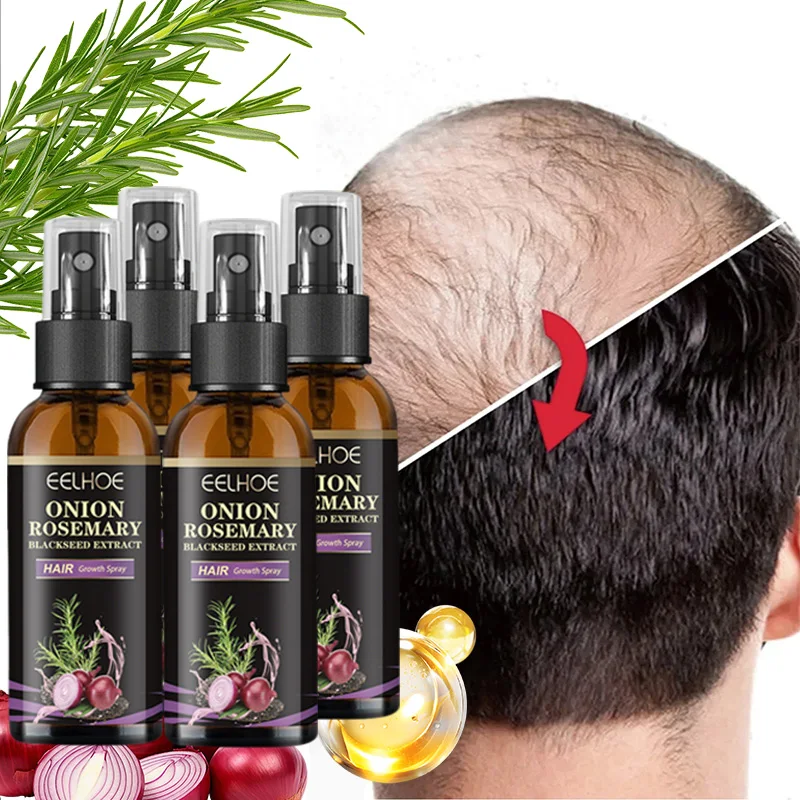 

4 Bottles 30ml Onion Rosemary Anti-Hair Loss Serum Rapid Hair Growth Conditioning Spray (for Men & Women)