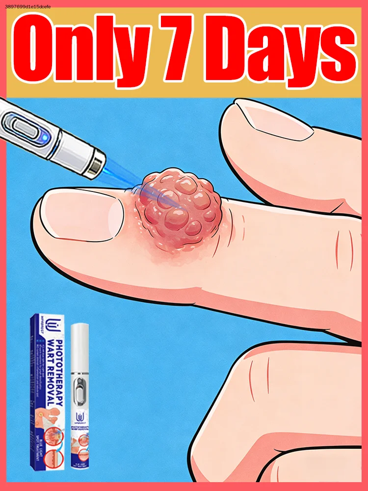 

Treat warts and live your life without any interruption⸴ ⁿᵒ ˡᵒⁿᵍᵉʳ ʰᵃᵛᵉ ᵗᵒ ʷᵒʳʳʸ ᵃᵇᵒᵘᵗ ʷᵃʳᵗˢ