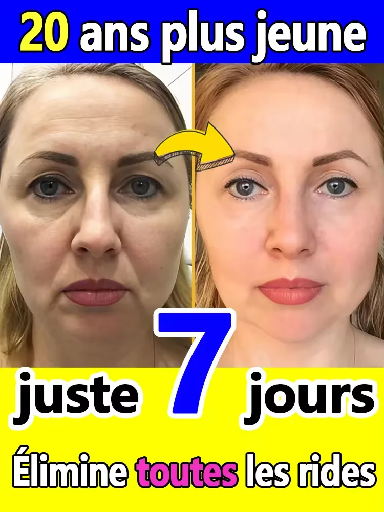 تغيير الجلد، قل وداعا للتجاعيد #1